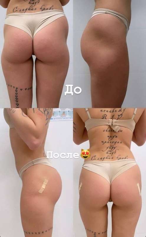 Хофманнита Photo #129